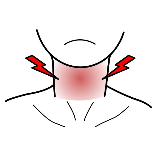 pharyngitis