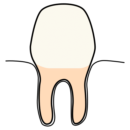 tooth