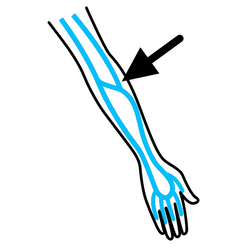 veins