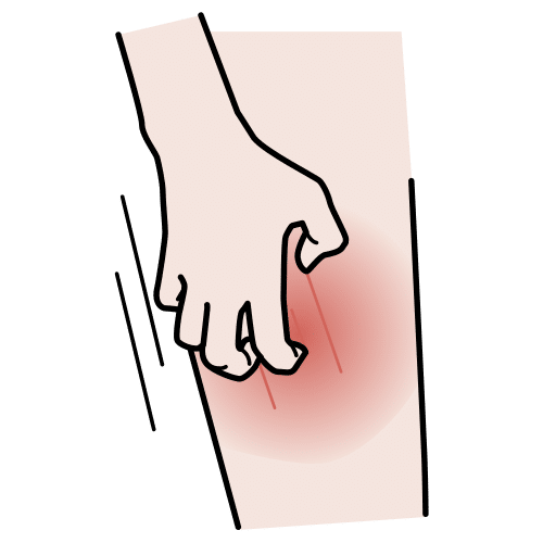 scratch