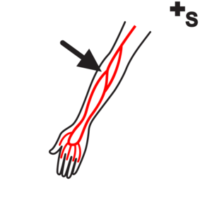 arteries