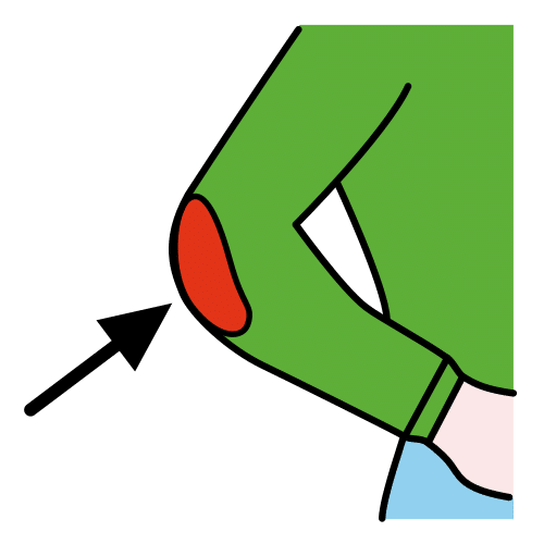 elbow patch