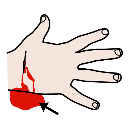blood