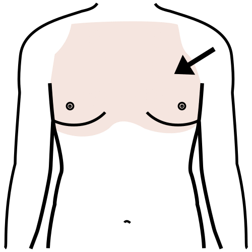 chest