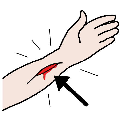 injury