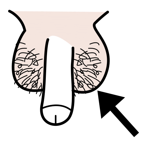 testicles