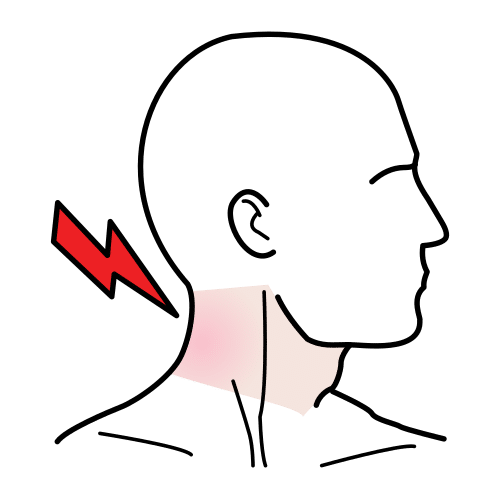 stiff neck