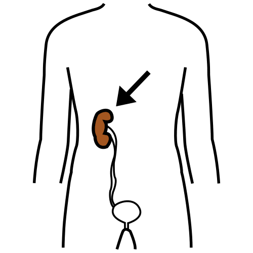 kidney