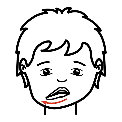 praxia