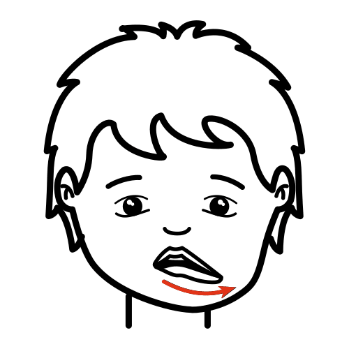 praxia