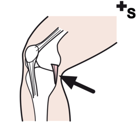 ligaments