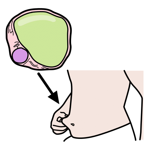 fat