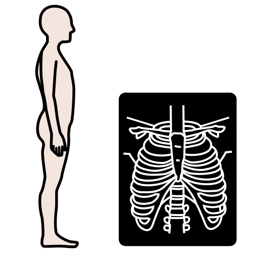 x-ray