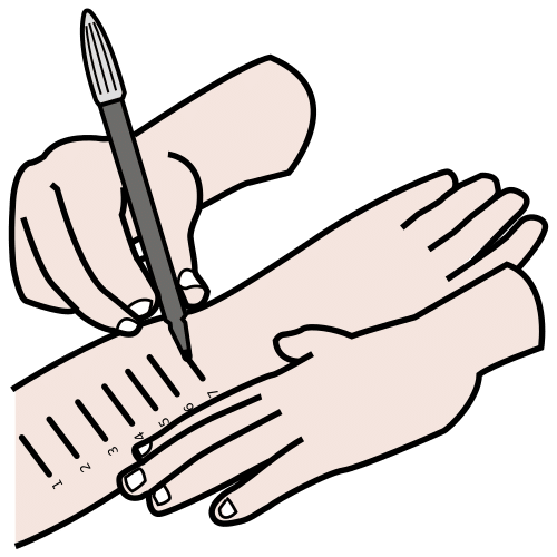 allergy testing