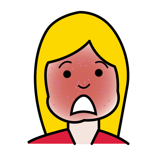 allergy