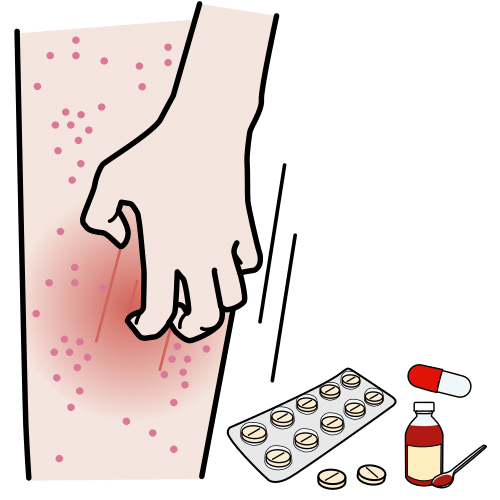 allergy