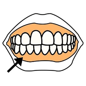tandkød