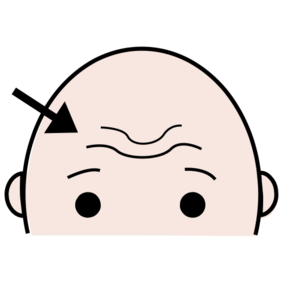 čelo