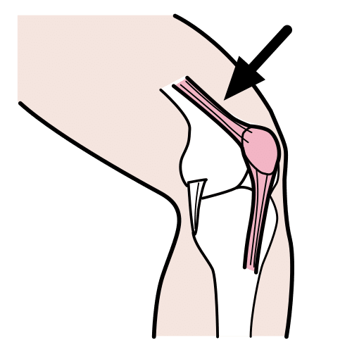 tendon