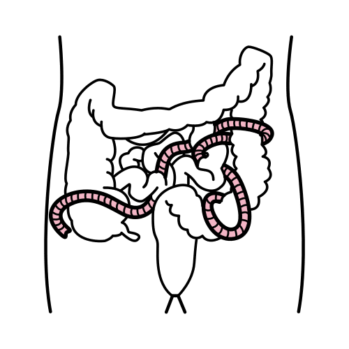 tapeworm