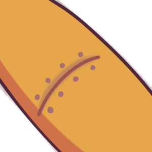 surgery scar