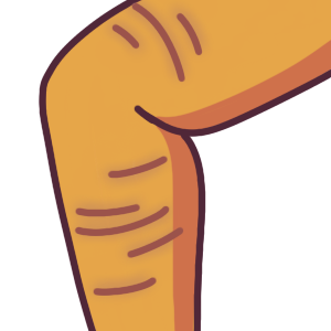 scarring on limb