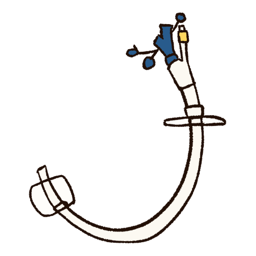 feeding tube