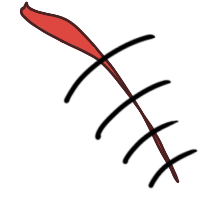 suture