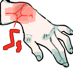 wrist pain